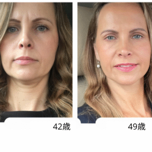 総合的なフェイシャルヨガプログラム